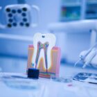 Ewolucja w endodoncji: Jak leczenie kanałowe zmieniło się na przestrzeni lat?