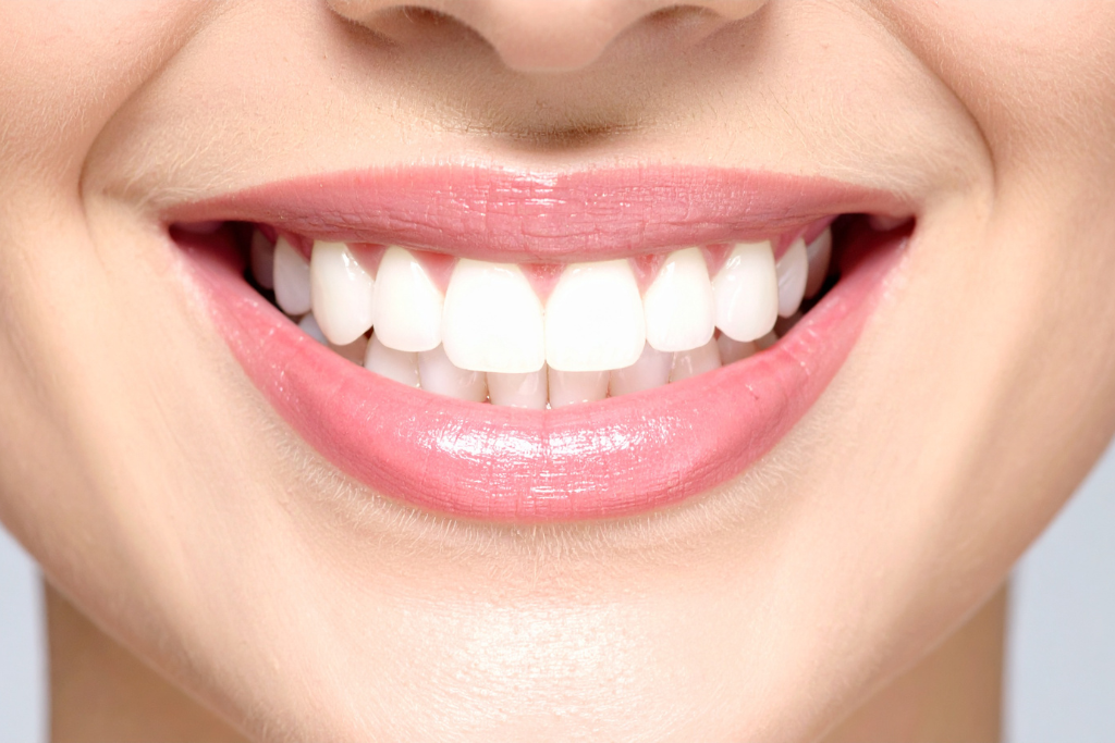 Bonding zębów w&nbsp;Poznaniu – szybka poprawa estetyki uśmiechu w&nbsp;Praktyka Dentystyczna